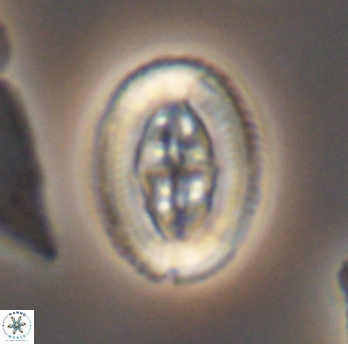 Pollicenotas furtivus 11805