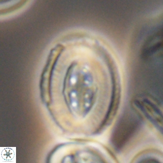 Pollicenotas furtivus 11845