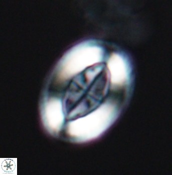 Pollicenotas furtivus 12004