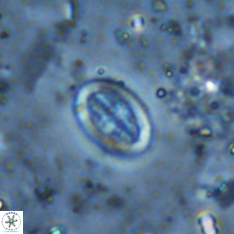 Pollicenotas minimus 35757