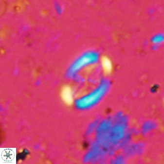 Pollicenotas minimus 35761