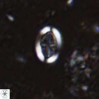 Pollicenotas minimus 35762