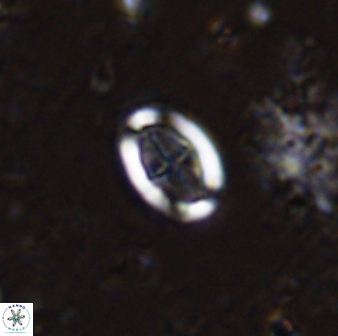 Pollicenotas minimus 35764