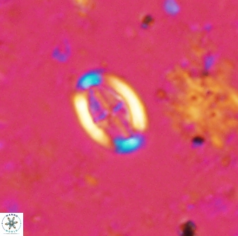 Pollicenotas minimus 35765
