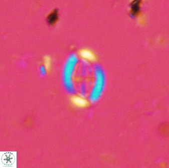 Pollicenotas minimus 35943