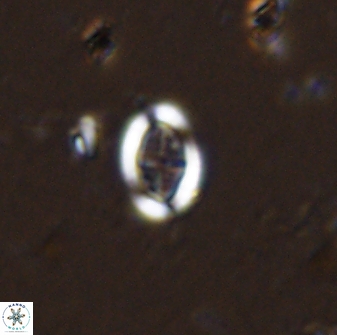 Pollicenotas minimus 35944
