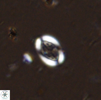 Pollicenotas minimus 35945