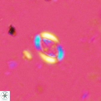 Pollicenotas minimus 35946