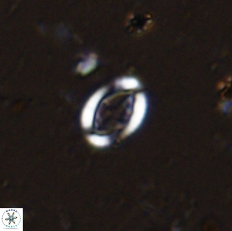 Pollicenotas minimus 35947
