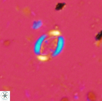 Pollicenotas minimus 35948