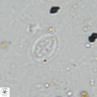 Pollicenotas minimus 35949