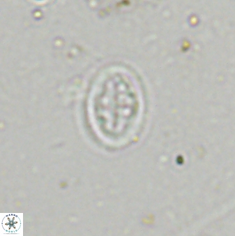 Pollicenotas minimus 36197