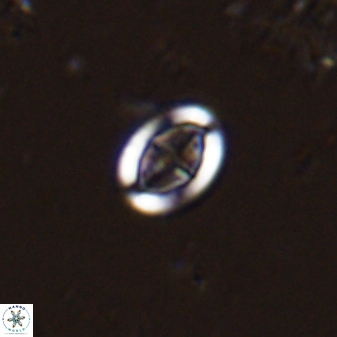 Pollicenotas minimus 36202