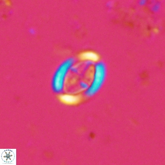 Pollicenotas minimus 36203
