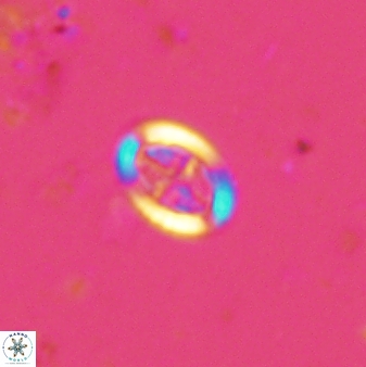 Pollicenotas minimus 36205