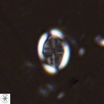 Pollicenotas minimus 37802