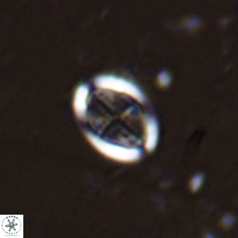 Pollicenotas minimus 37804