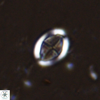 Pollicenotas minimus 37809