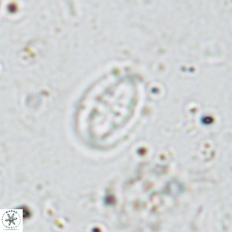 Pollicenotas minimus 35759