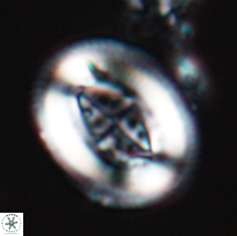 Pollicenotas parcus 16701