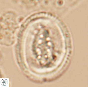 Pollicenotas parcus 10246