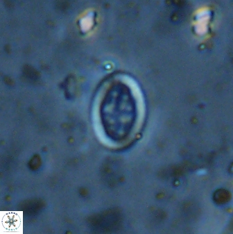 Pollicenotas minimus 35954