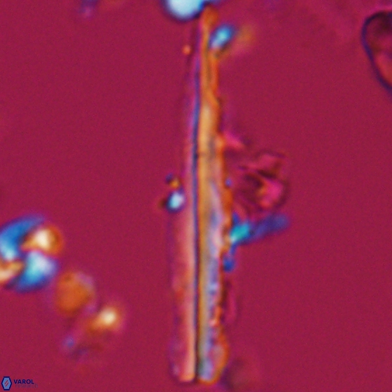 Pseudotriquetrorhabdulus inversus 25840