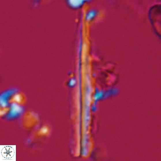 Pseudotriquetrorhabdulus inversus 25840