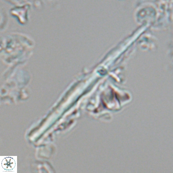Pseudotriquetrorhabdulus inversus 25845