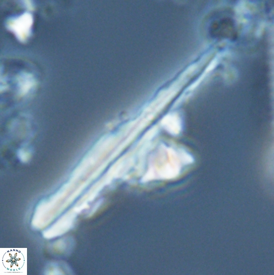 Pseudotriquetrorhabdulus inversus 25846