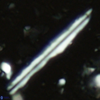 Pseudotriquetrorhabdulus inversus VR 02449