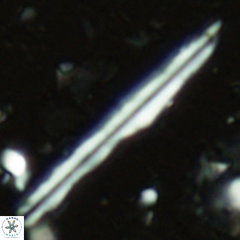 Pseudotriquetrorhabdulus inversus VR 02449