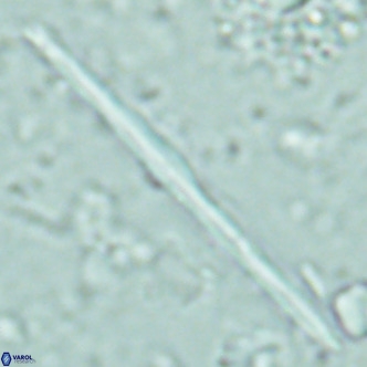 Pseudotriquetrorhabdulus inversus VR 02452