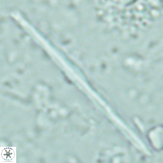 Pseudotriquetrorhabdulus inversus VR 02452