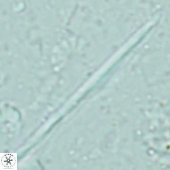 Pseudotriquetrorhabdulus inversus VR 02453