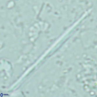 Pseudotriquetrorhabdulus inversus VR 02454