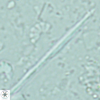 Pseudotriquetrorhabdulus inversus VR 02454