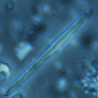 Pseudotriquetrorhabdulus inversus VR 02455