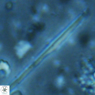 Pseudotriquetrorhabdulus inversus VR 02455