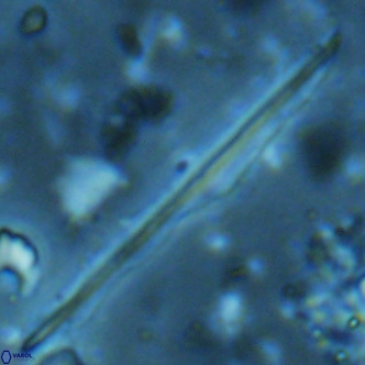 Pseudotriquetrorhabdulus inversus VR 02456