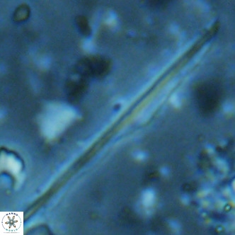 Pseudotriquetrorhabdulus inversus VR 02456