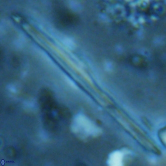 Pseudotriquetrorhabdulus inversus VR 02457