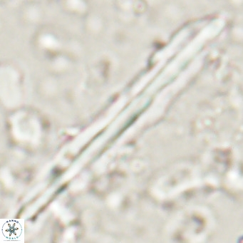 Pseudotriquetrorhabdulus inversus VR 025794