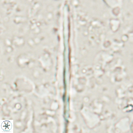 Pseudotriquetrorhabdulus inversus VR 025795