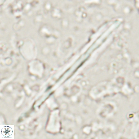 Pseudotriquetrorhabdulus inversus VR 025796