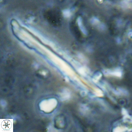 Pseudotriquetrorhabdulus inversus VR 025799