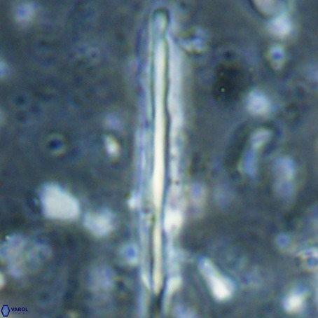 Pseudotriquetrorhabdulus inversus VR 025800