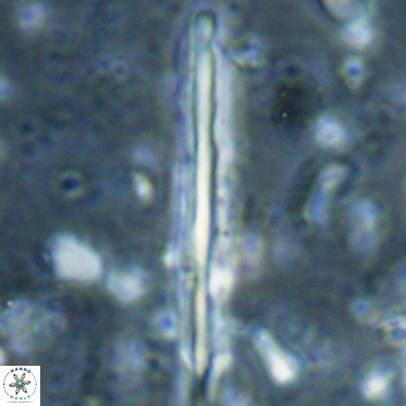 Pseudotriquetrorhabdulus inversus VR 025800