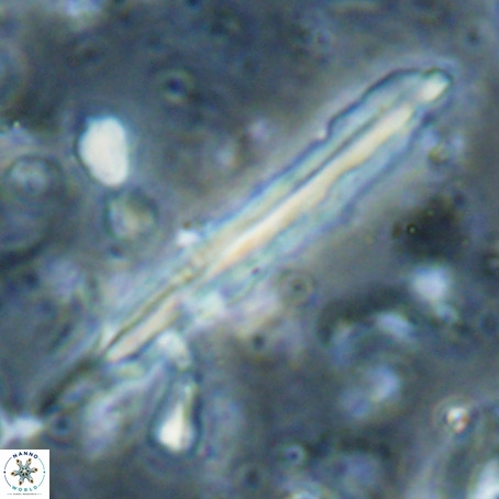 Pseudotriquetrorhabdulus inversus VR 025801