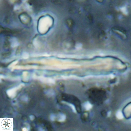Pseudotriquetrorhabdulus inversus VR 025802